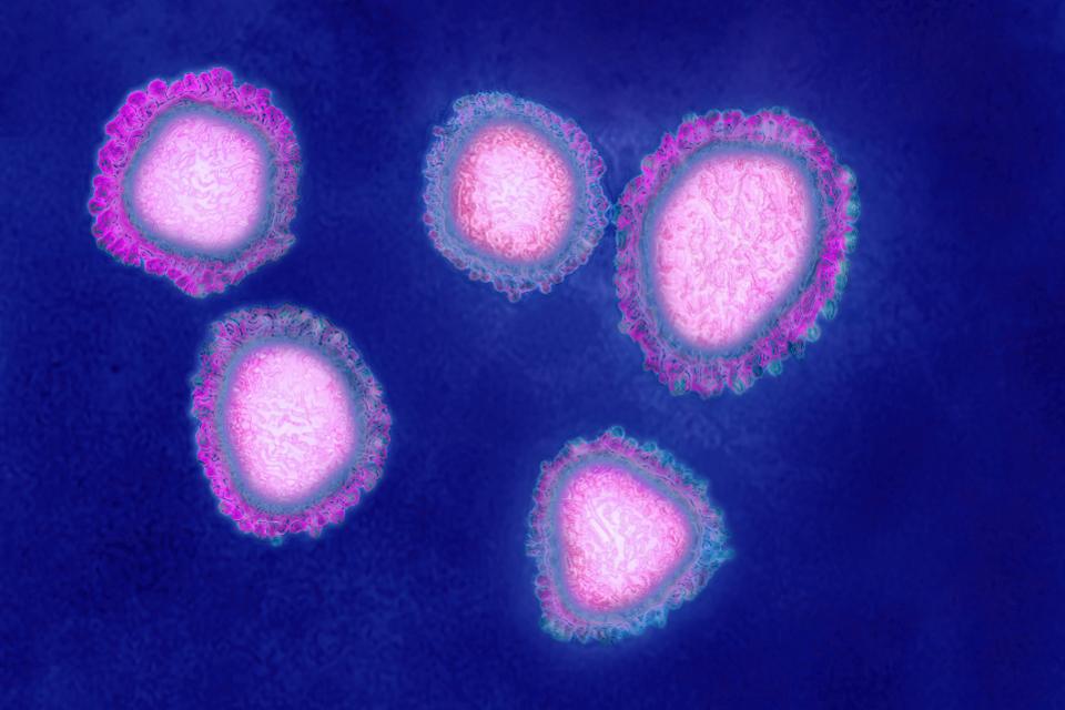 Phát hiện chủng Coronavirus mới gây dịch viêm phổi ở Trung Quốc