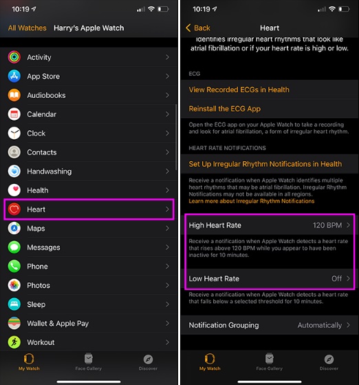 Apple Watch làm được gì? Có thể phát hiện những vấn đề sức khỏe nào?